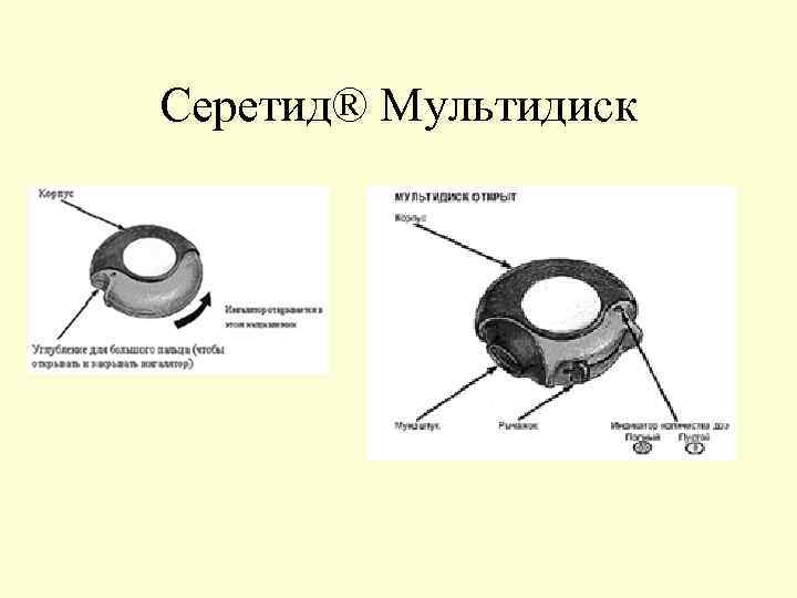 Серетид® Мультидиск 