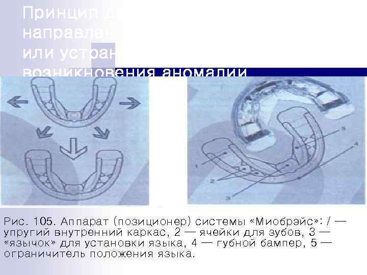 Принцип действия аппарата направлен на предупреждение или устранение причины возникновения аномалии Рис. 105. Аппарат