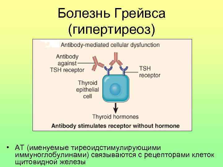 Болезнь Грейвса (гипертиреоз) • АТ (именуемые тиреоидстимулирующими иммуноглобулинами) связываются с рецепторами клеток щитовидной железы