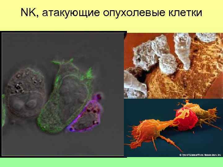 NK, атакующие опухолевые клетки 