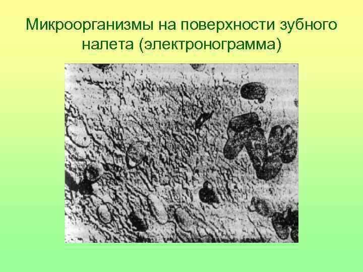 Микроорганизмы на поверхности зубного налета (электронограмма) 
