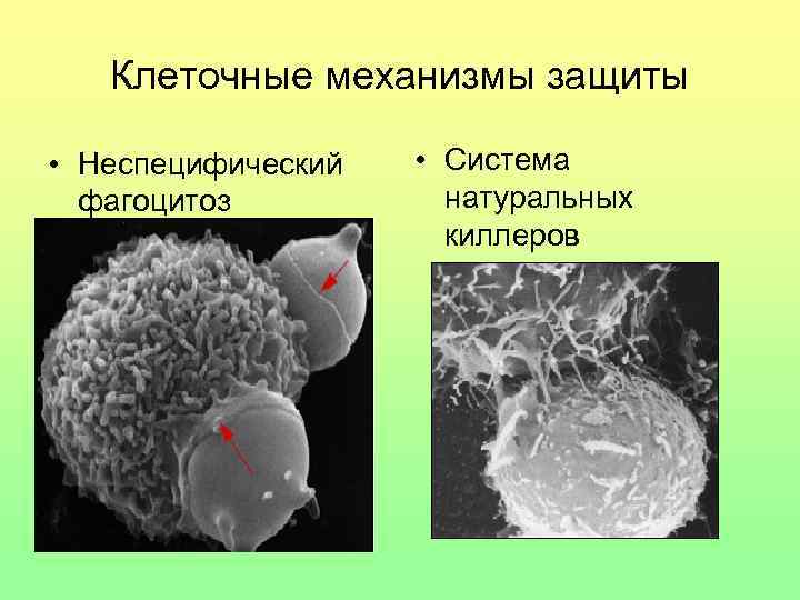 Клеточные механизмы защиты • Неспецифический фагоцитоз • Система натуральных киллеров 