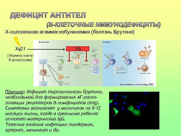 Х-сцепленная агаммаглобулинемия (болезнь Брутона) Xq 21 ТКБ (длинное плечо Х-хромосомы) Причина: дефицит тирозинкиназы Брутона,