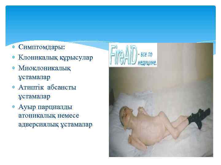  Симптомдары: Клоникалық құрысулар Миоклоникалық ұстамалар Атиптік абсансты ұстамалар Ауыр парциалды атоникалық немесе адверсиялық