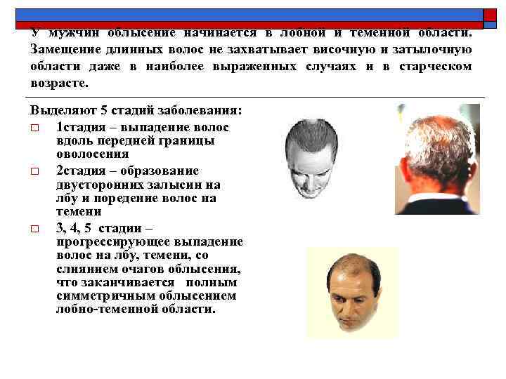 У мужчин облысение начинается в лобной и теменной области. Замещение длинных волос не захватывает