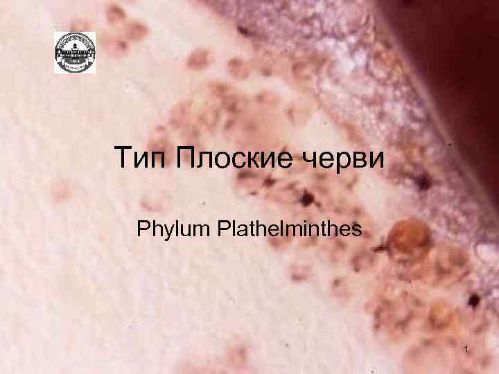 Тип Плоские черви Phylum Plathelminthes 1 