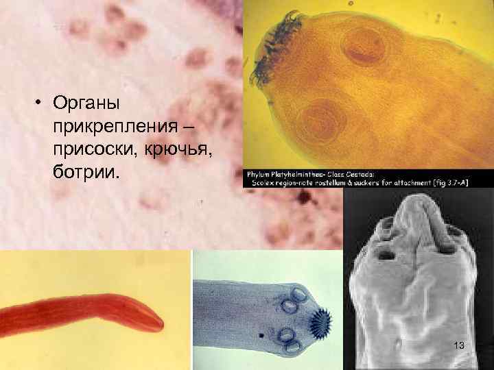  • Органы прикрепления – присоски, крючья, ботрии. 13 