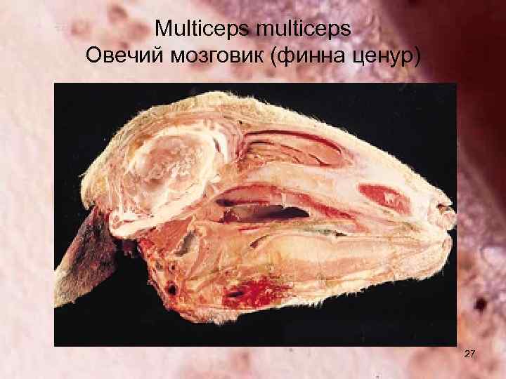 Multiceps multiceps Овечий мозговик (финна ценур) 27 
