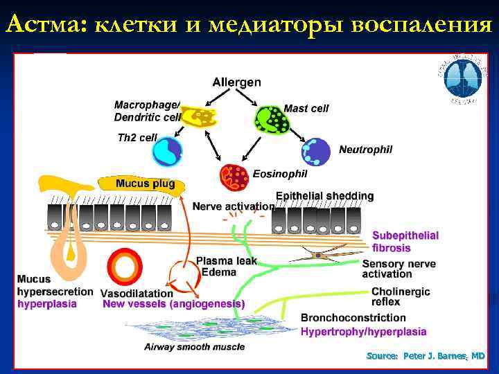 Астма: клетки и медиаторы воспаления Source: Peter J. Barnes, MD 5 