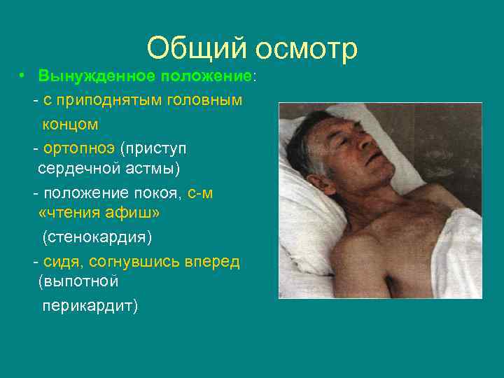 Общий осмотр • Вынужденное положение: - с приподнятым головным концом - ортопноэ (приступ сердечной