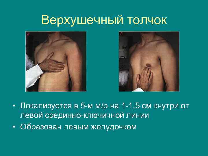 Верхушечный толчок • Локализуется в 5 -м м/р на 1 -1, 5 см кнутри