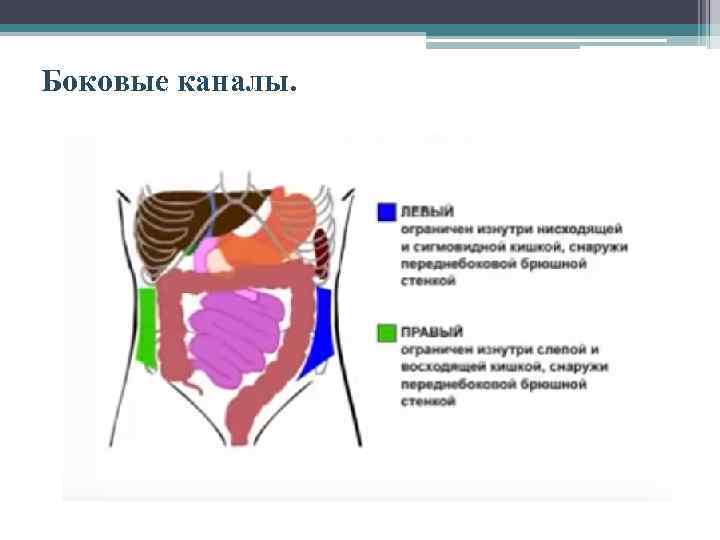 Схема распространения патологических процессов по брюшной полости