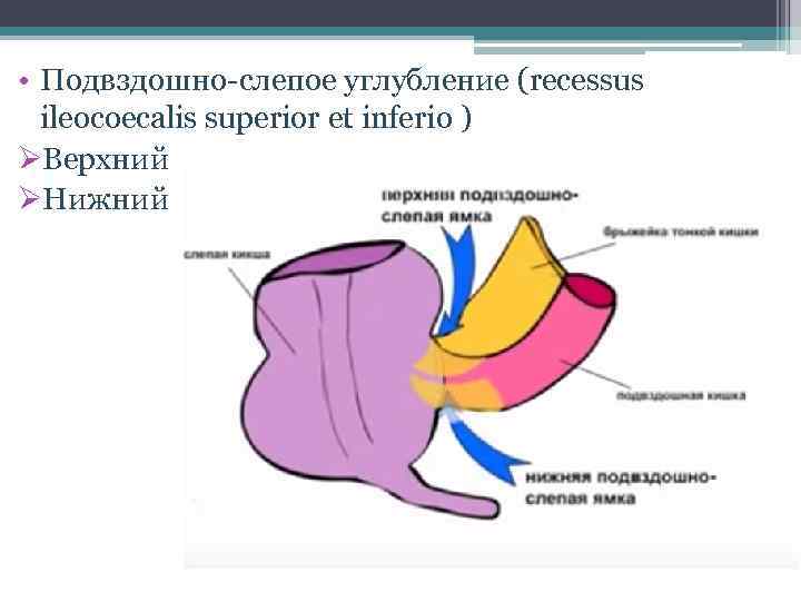  • Подвздошно-слепое углубление (recessus ileocoecalis superior et inferio ) ØВерхний ØНижний 