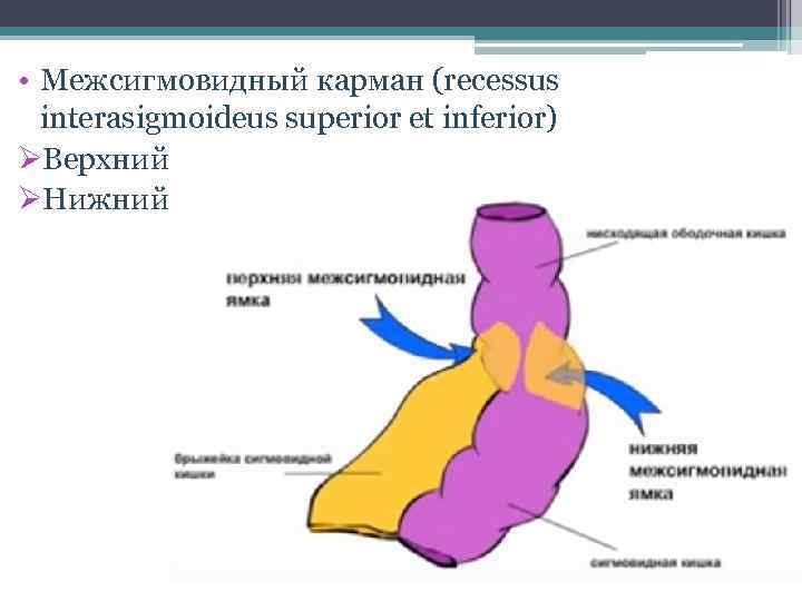  • Межсигмовидный карман (recessus interasigmoideus superior et inferior) ØВерхний ØНижний 