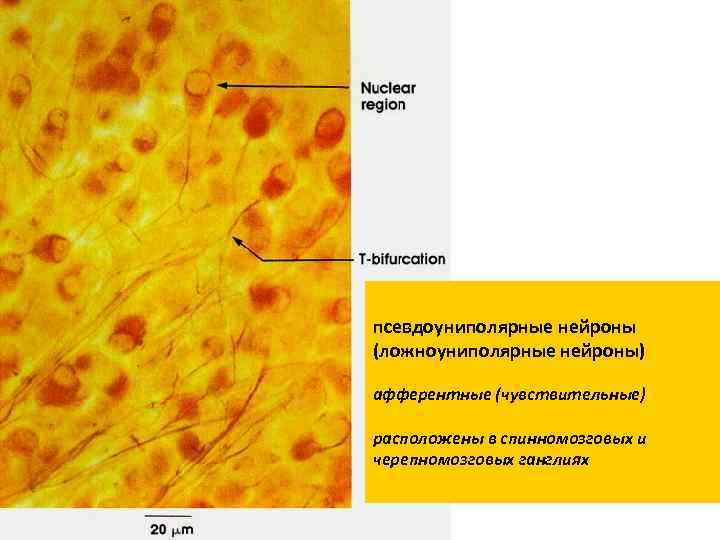 псевдоуниполярные нейроны (ложноуниполярные нейроны) афферентные (чувствительные) расположены в спинномозговых и черепномозговых ганглиях 