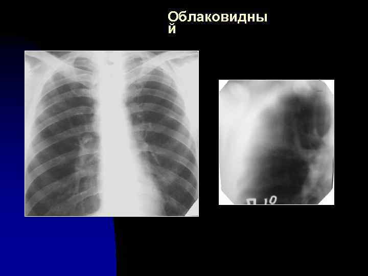Облаковидны й 