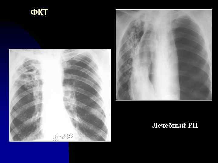 ФКТ Лечебный PH 