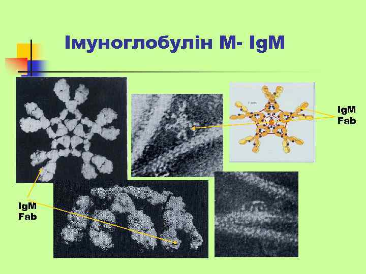 Імуноглобулін М- Ig. M Fab 