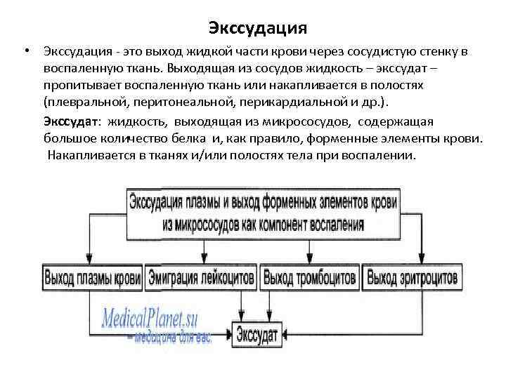 Какие процессы предшествуют экссудации см схему