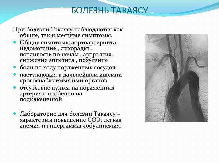 Аорта клинические рекомендации