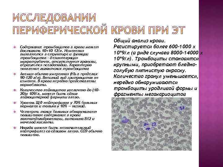  Содержание тромбоцитов в крови может достигать 10× 10 12/л. Изменения выявляются в структуре