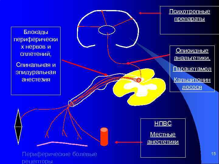 Обезболивающая блокада. Комбинированная спинально эпидуральная анестезия КСЭА. Комбинированная спинально-эпидуральная анестезия показания. Спинальная анестезия и эпидуральная показания. Периферические нервные блокады.