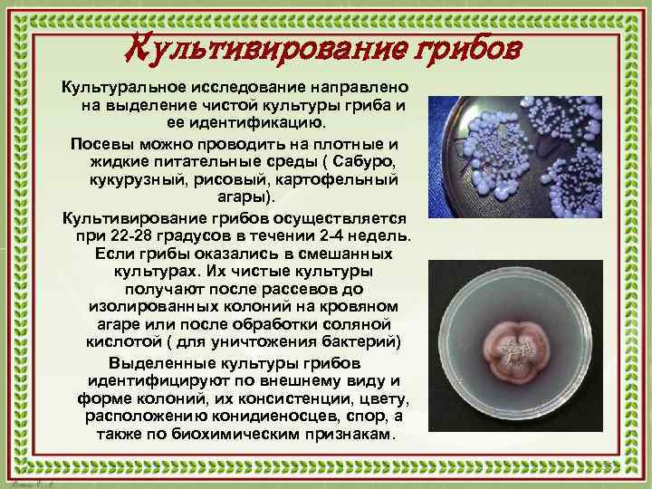 Культивирование грибов Культуральное исследование направлено на выделение чистой культуры гриба и ее идентификацию. Посевы