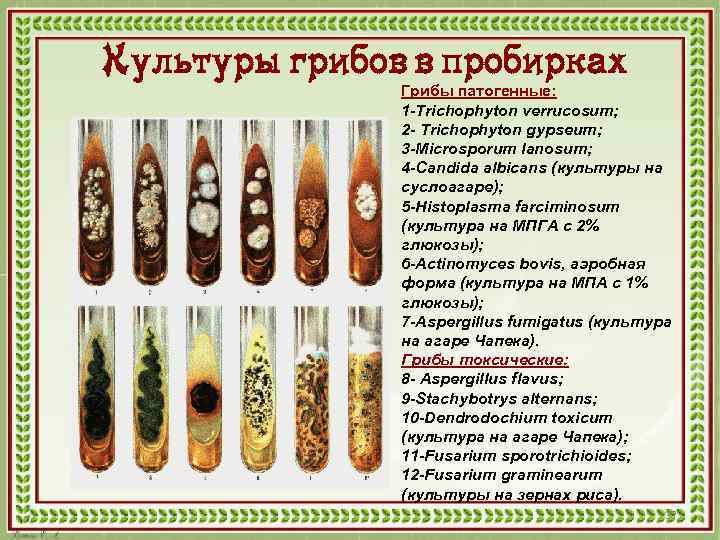 Культуры грибов в пробирках Грибы патогенные: 1 -Trichophyton verrucosum; 2 - Trichophyton gypseum; 3