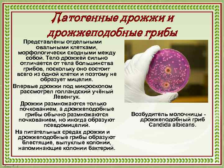 Патогенные дрожжи и дрожжеподобные грибы Представлены отдельными овальными клетками, морфологически сходными между собой. Тело