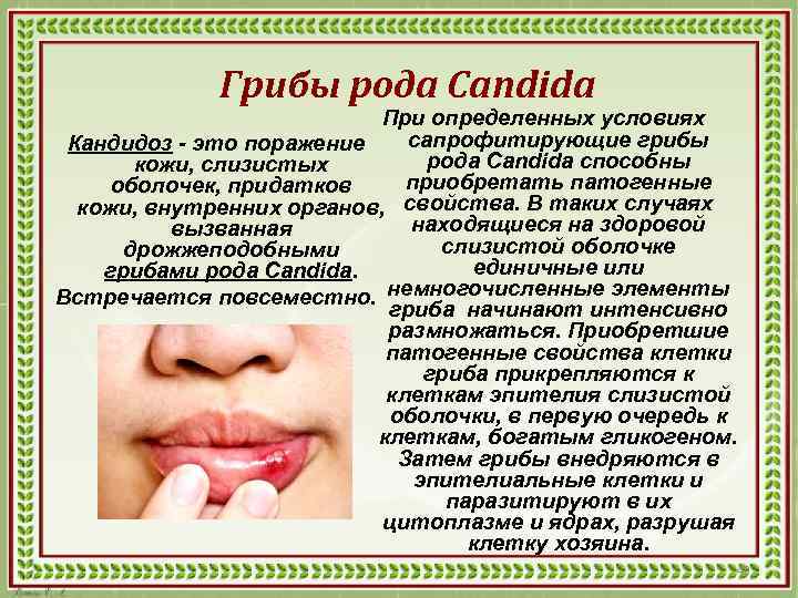Грибы рода Candida При определенных условиях сапрофитирующие грибы Кандидоз - это поражение рода Candida