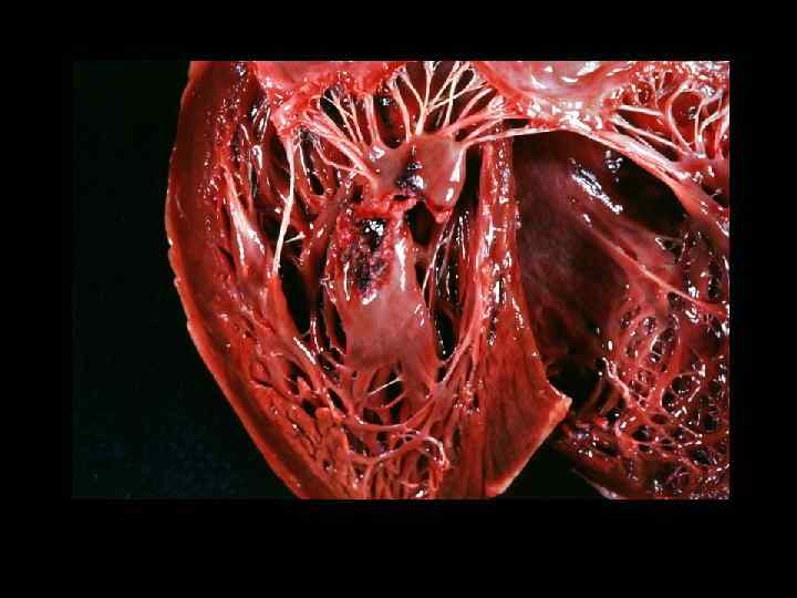 Митральные пороки этиология и патогенез Докладчик