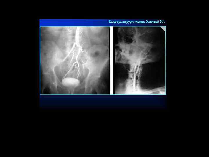 Кафедра хирургических болезней № 1 