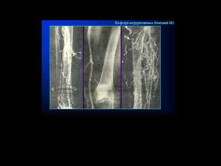 Кафедра хирургических болезней № 1 
