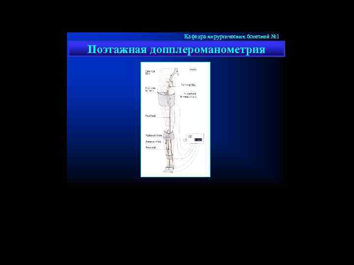 Кафедра хирургических болезней № 1 Поэтажная допплероманометрия 