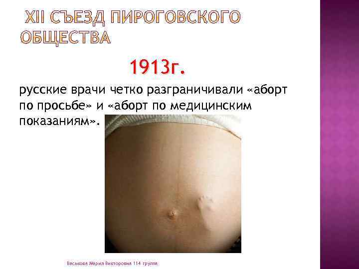 1913 г. русские врачи четко разграничивали «аборт по просьбе» и «аборт по медицинским показаниям»