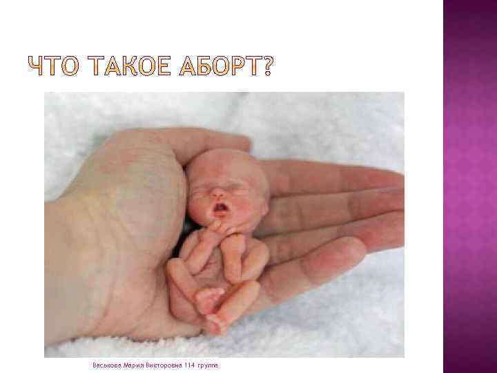 (искусственный аборт, от лат. abortus — «выкидыш» ) — искусственное прерывание беременности Васькова Мария