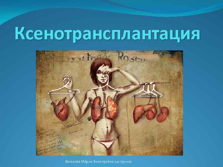 Ксенотрансплантация Васькова Мария Викторовна 114 группа 