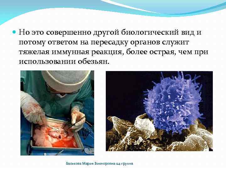  Но это совершенно другой биологический вид и потому ответом на пересадку органов служит