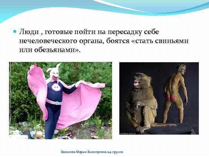  Люди , готовые пойти на пересадку себе нечеловеческого органа, боятся «стать свиньями или