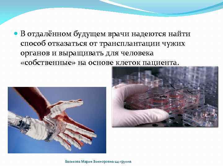  В отдалённом будущем врачи надеются найти способ отказаться от трансплантации чужих органов и