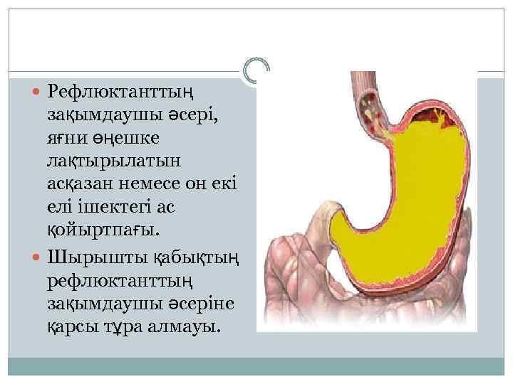 Асқазан обыры презентация