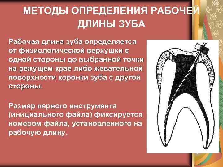 Рабочая длина. Методы определения рабочей длины зуба. Рабочая длина зуба методики определения. Способы определения рабочей длины зуба. Измерение рабочей длины зуба.