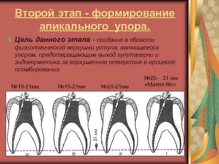 Эндодонтическое лечение презентация