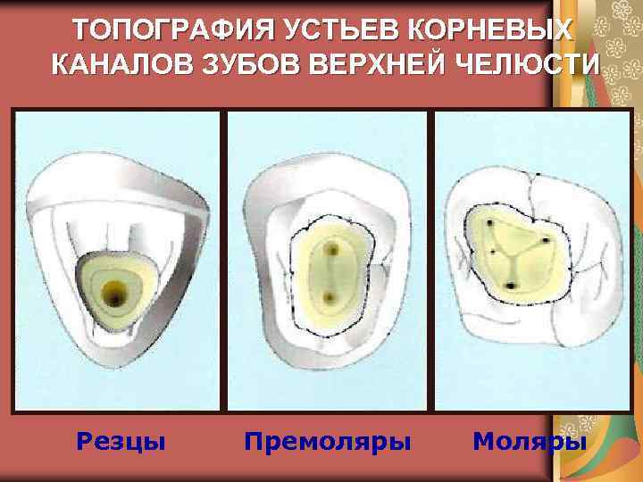 Устья корневых каналов схема