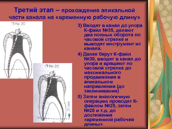 Эндодонтическое лечение презентация