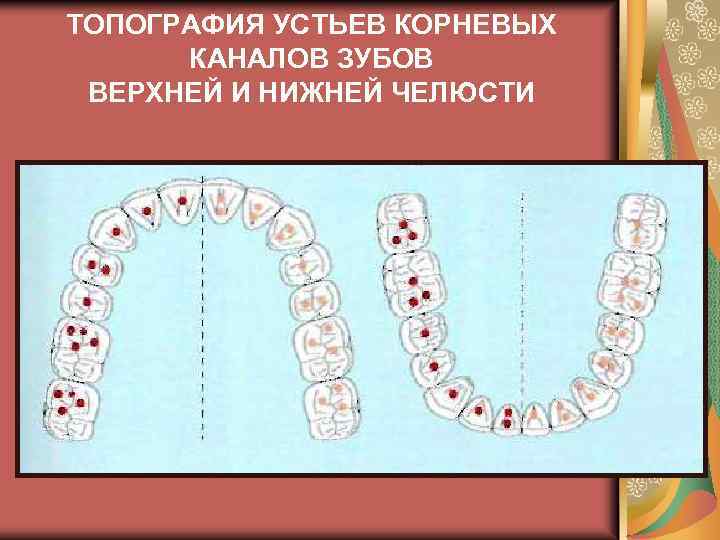 Методы лечения зубов с проблемными корневыми каналами презентация