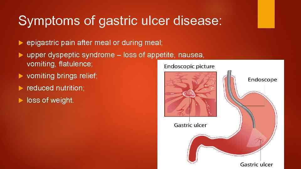 Symptoms of gastric ulcer disease: epigastric pain after meal or during meal; upper dyspeptic