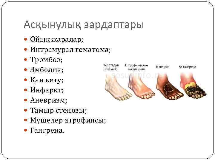 Асқынулық зардаптары Ойық жаралар; Интрамурал гематома; Тромбоз; Эмболия; Қан кету; Инфаркт; Аневризм; Тамыр стенозы;