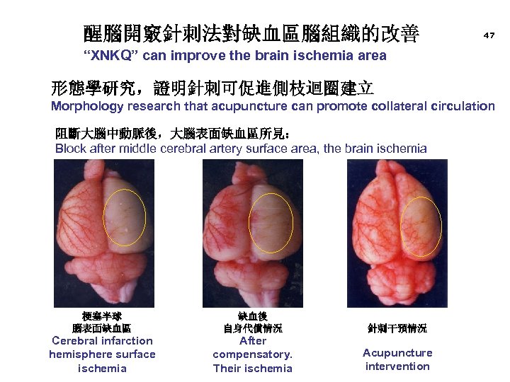 醒腦開竅針刺法對缺血區腦組織的改善 47 “XNKQ” can improve the brain ischemia area 形態學研究，證明針刺可促進側枝迴圈建立 Morphology research that acupuncture