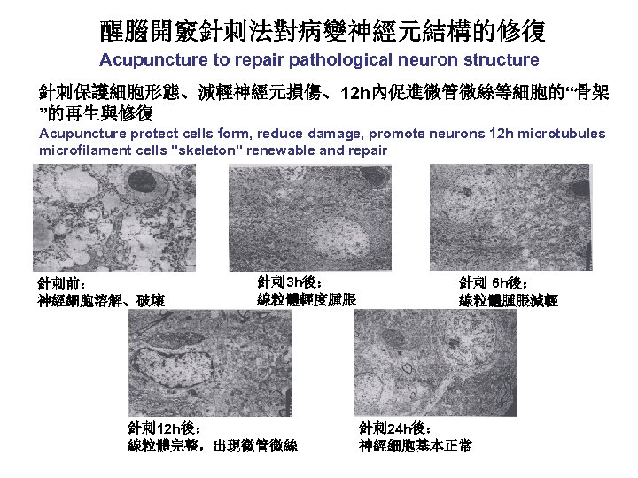 醒腦開竅針刺法對病變神經元結構的修復 Acupuncture to repair pathological neuron structure 針刺保護細胞形態、減輕神經元損傷、12 h內促進微管微絲等細胞的“骨架 ”的再生與修復 Acupuncture protect cells form,